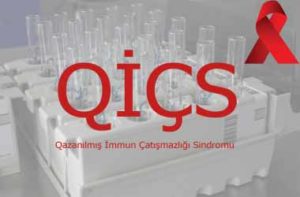 qics-foto-son-380x250